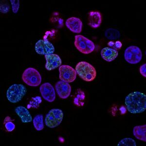 Optimizing HPLC Peptide Purity Assays for Complex Raw Materials